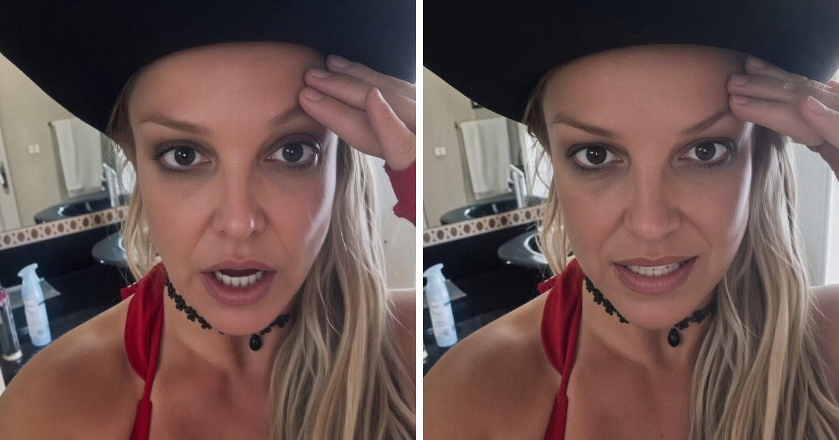 Britney Spears upozorila na opasnosti botoksa nakon lošeg iskustva