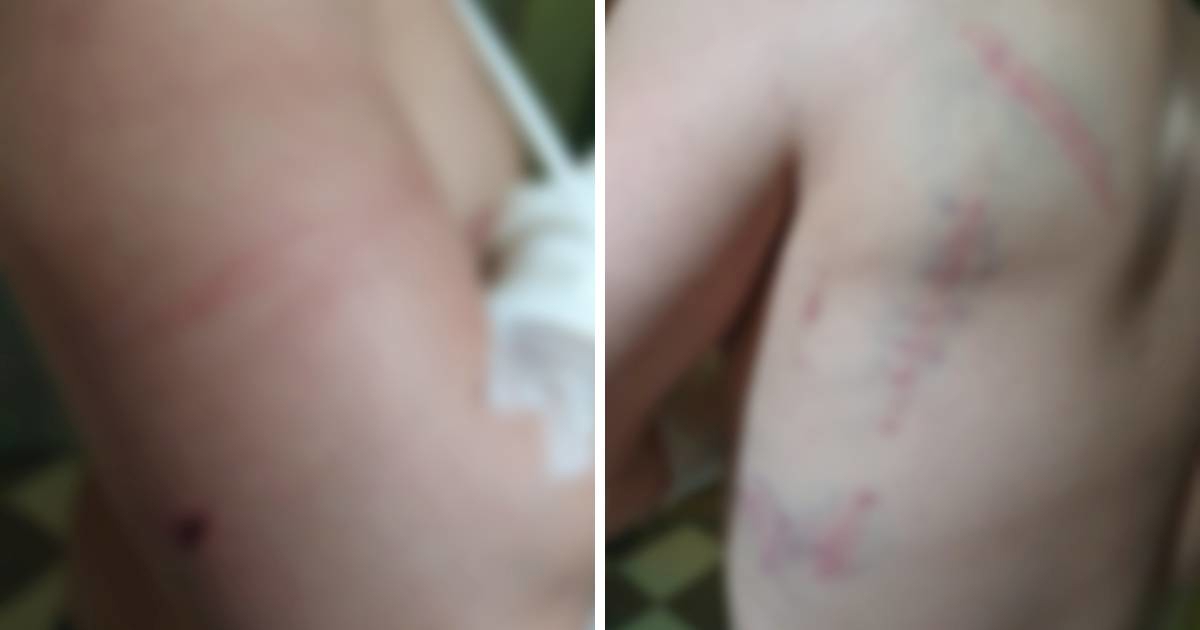 Organizirao premlaćivanje običnih ljudi u Splitu, sad ga traže zbog naci-kortea