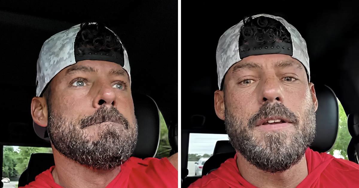 Bodybuilder isprobao "najjaču injekciju za mršavljenje na svijetu", podijelio dojmove