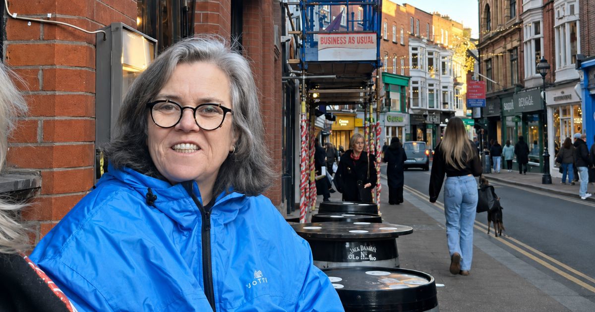 Rosie O'Donnell podijelila nefiltrirane fotke prije i poslije faceliftinga