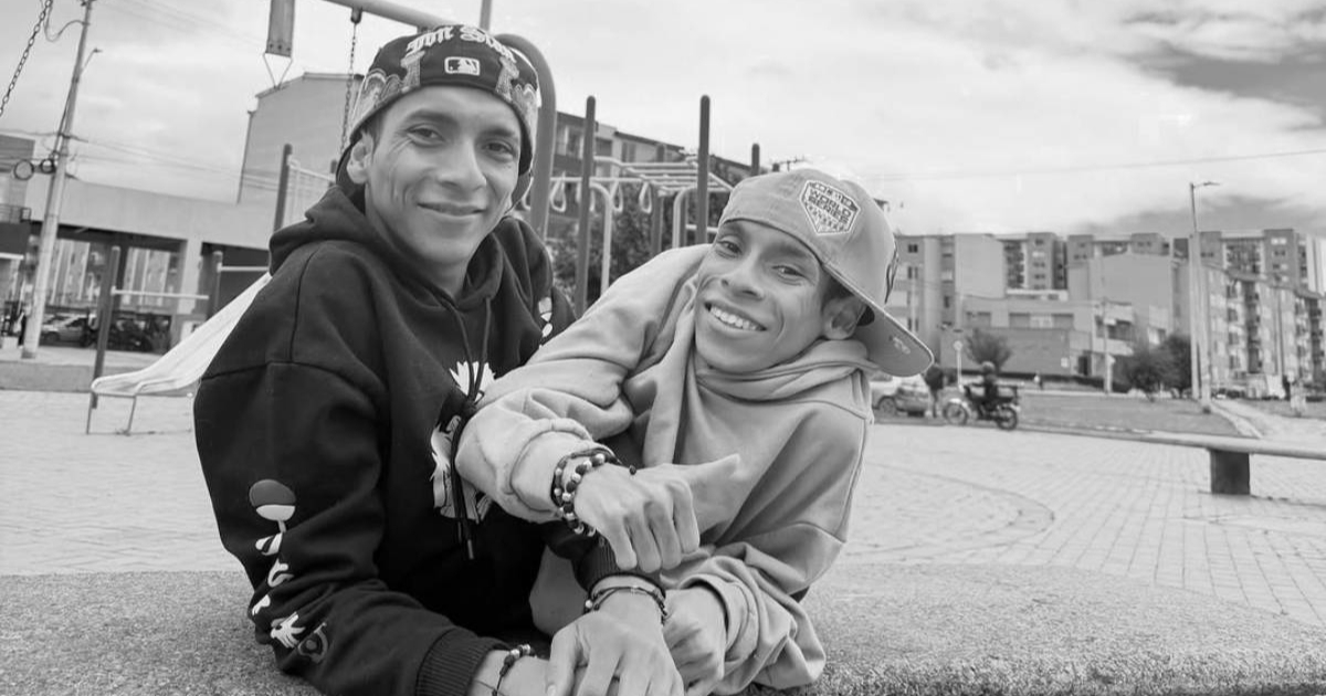 Umrli sijamski blizanci i influenceri Jose Luis i Jose Armando