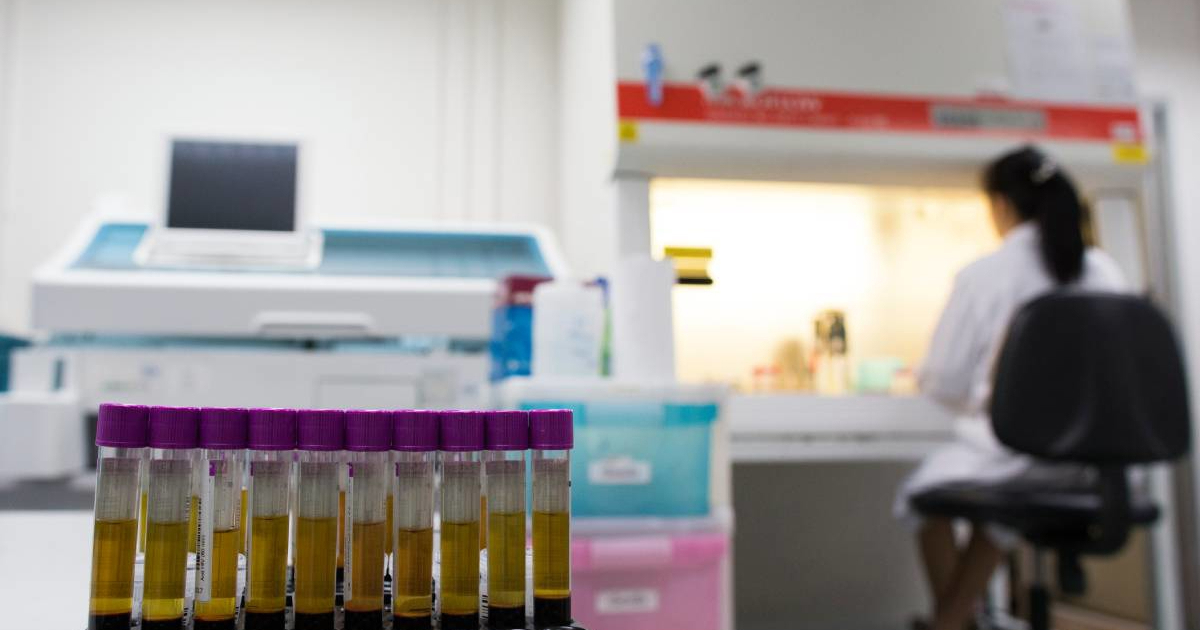 UN-ova agencija upozorava: Svijetu prijeti povratak epidemije HIV-a