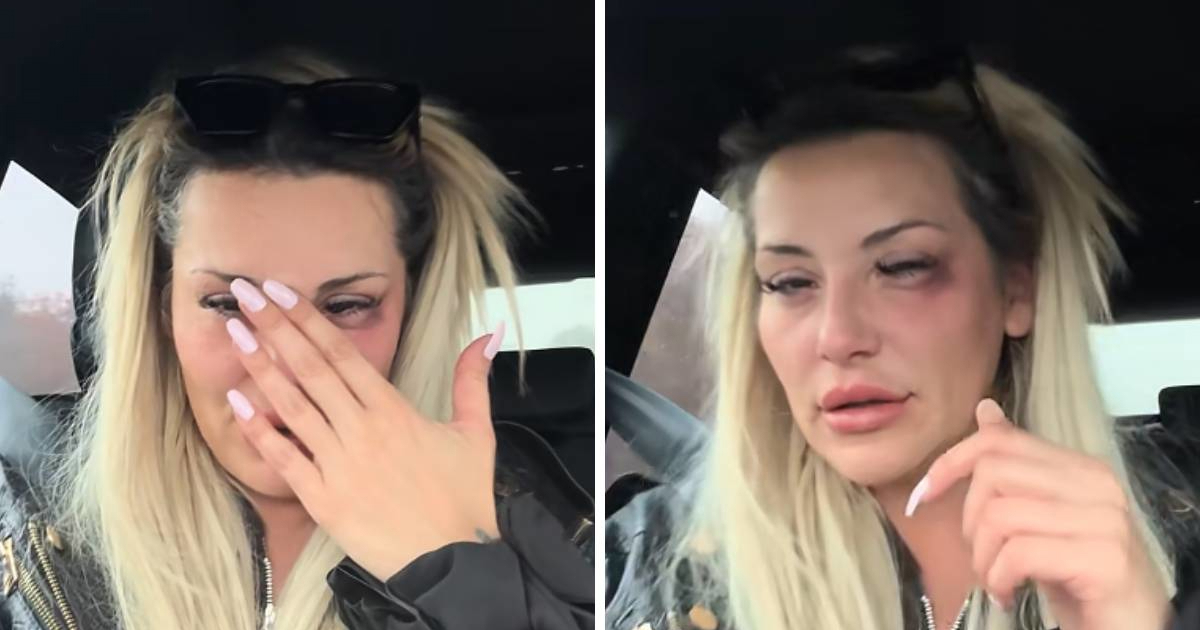 Pjevačica Monika Ivkić kroz suze: Vlasnica kluba u Njemačkoj udarila me šakom u oko